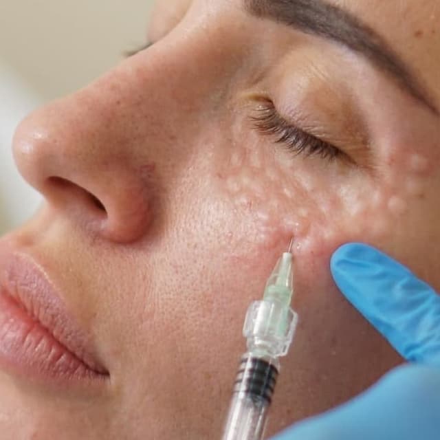 Korean Undereye Treatment ✨ at NATURAL CARE DOC - Holistic Medspa in Phoenix, AZ